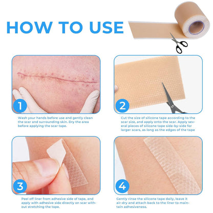Scar Free Skin Tape - Smooth Skin, Scar-Free Confidence